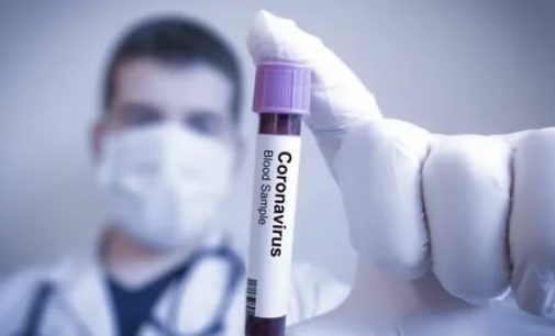 Шумораи гирифторони бемории коронавируси нави КОВИД-19 ба 1729  нафар расид