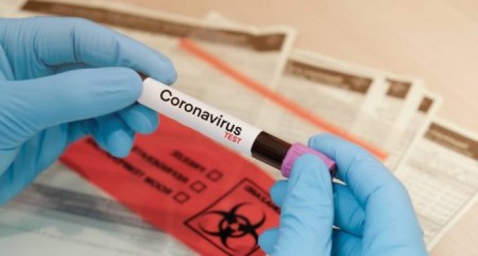 661 ҳолати сирояти коронавируси нави COVID-19 ошкор гардид